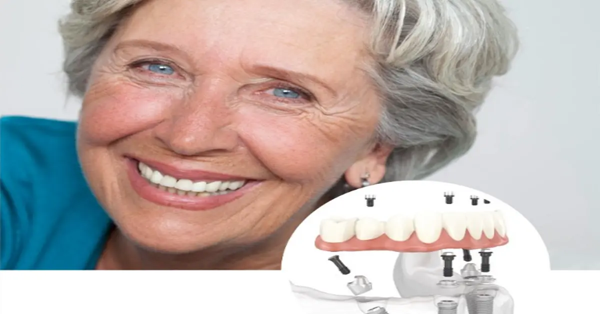 NYC’s Top All-on-4 Implant Specialists: Smile with Confidence